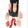 Kit de Heridas Neonatal